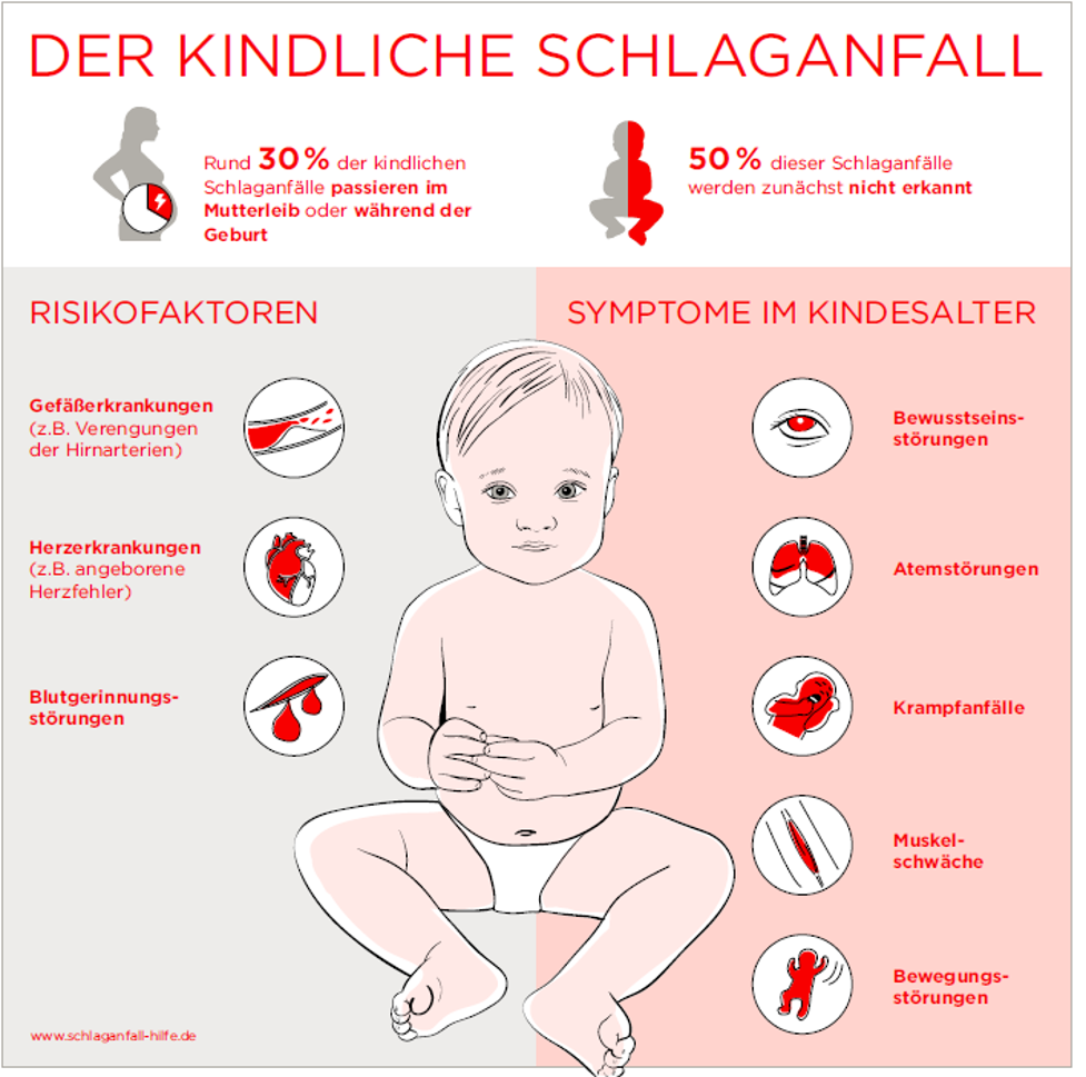 Expertenkreis Zum Kindlichen Schlaganfall